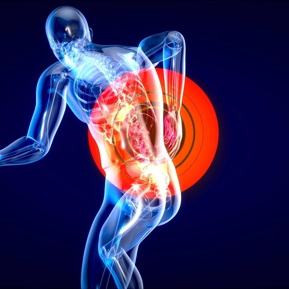 Symbolfoto einer männlichen Wirbelsäule mit rotem Schmerzrkreis