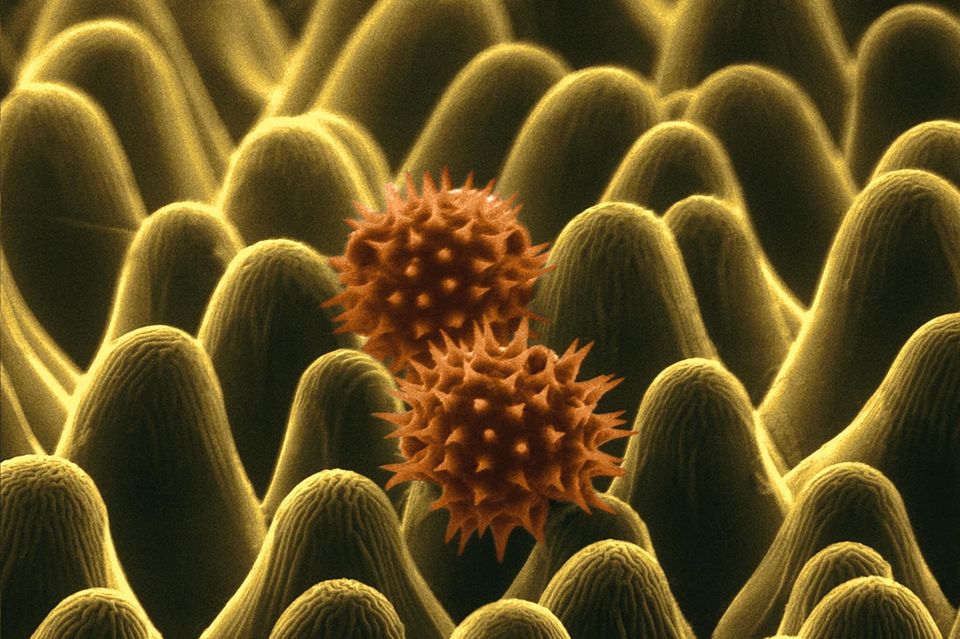 Sonnenblumen Pollen rasterelektronenmikroskopische Aufnahme  1