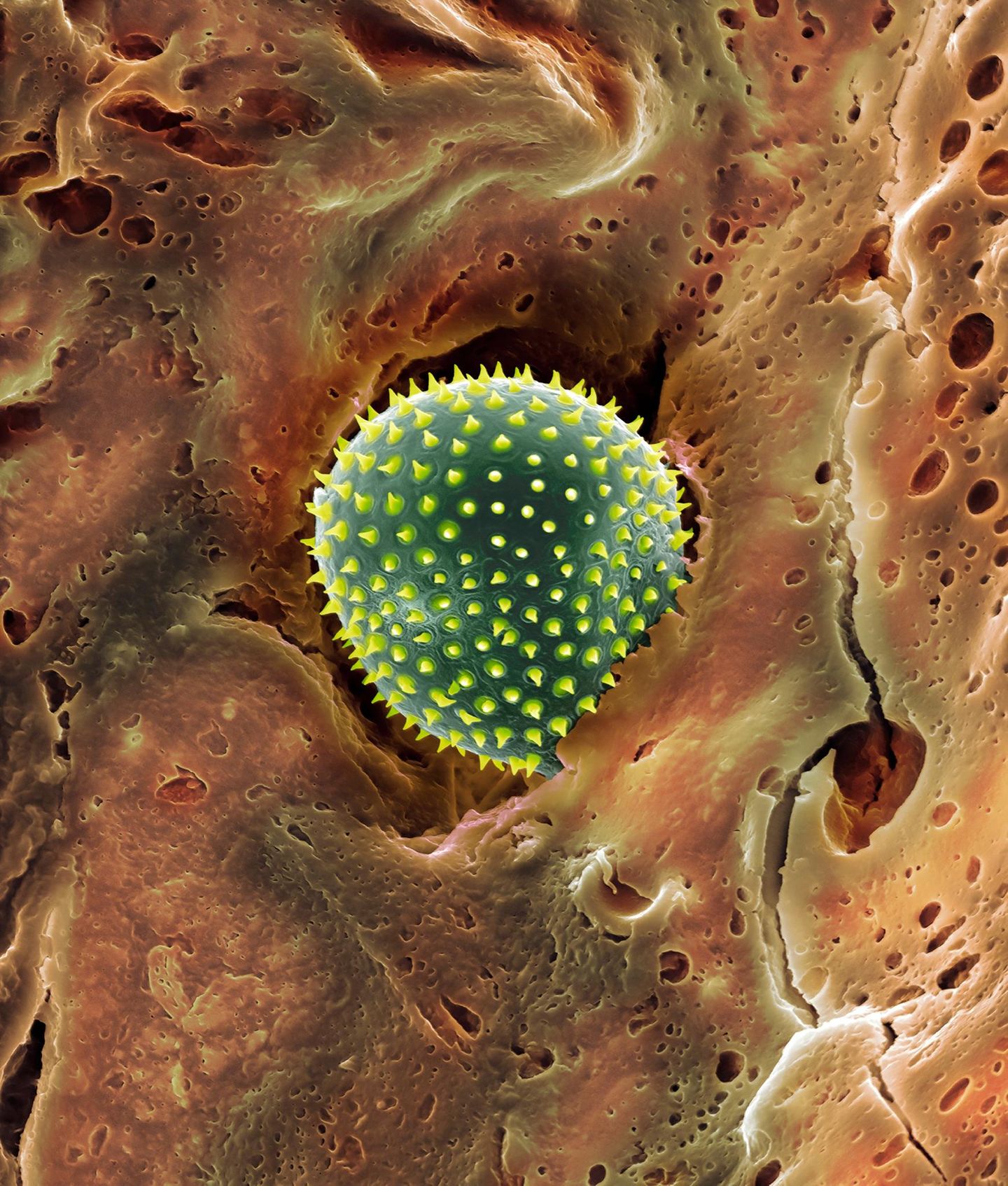 Pollen im Nasenhaar rasterelektronenmikroskopische Aufnahme