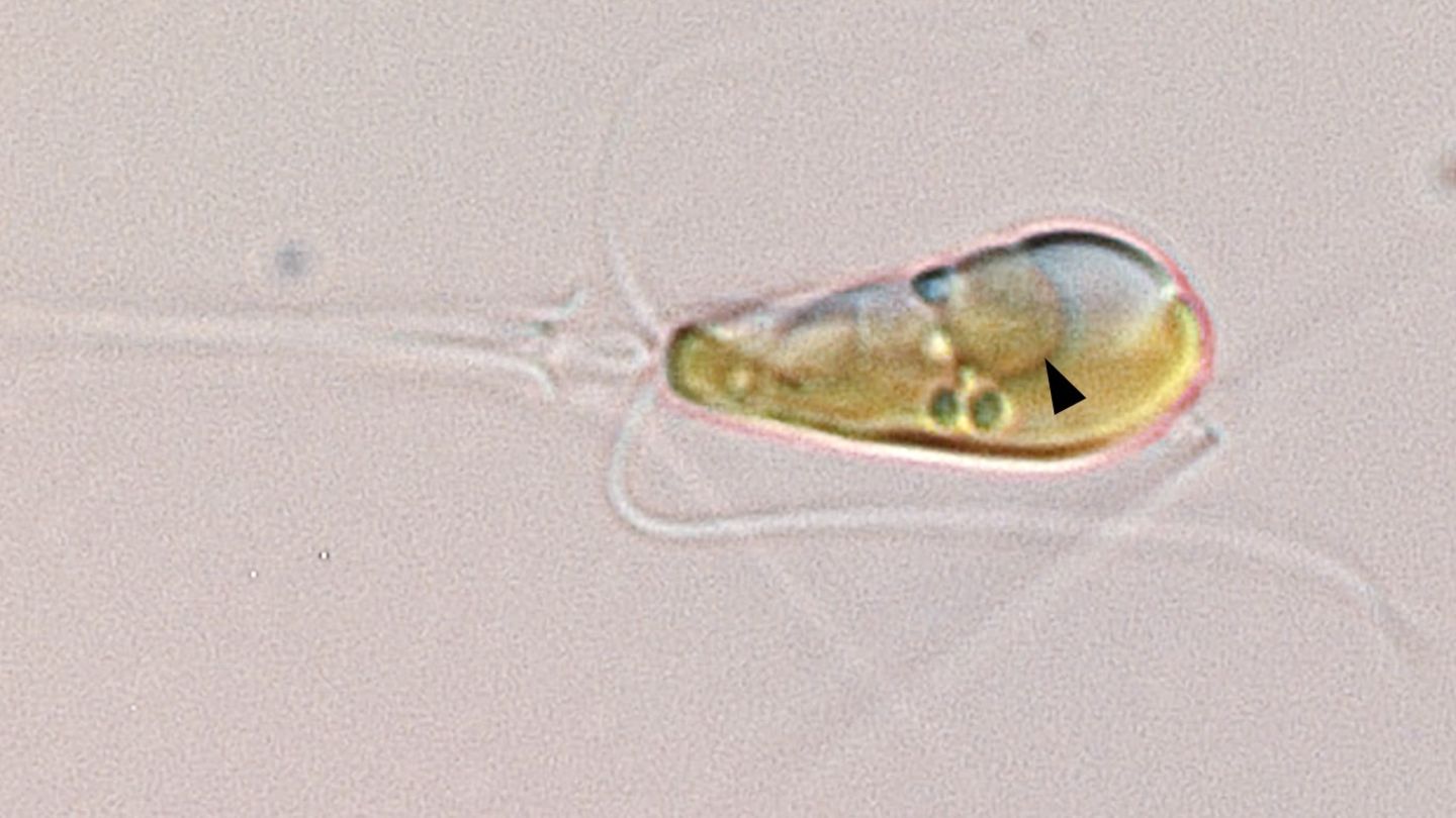 Die Alge Braarudospharea bigelowii in 1000facher Vergrößerung. Der schwarze Pfeil zeigt auf ein Zellorgan, das sich im Laufe der Evolution aus einem Bakterium entwickelt hat und Stickstoff aus der Luft gewinnen kann