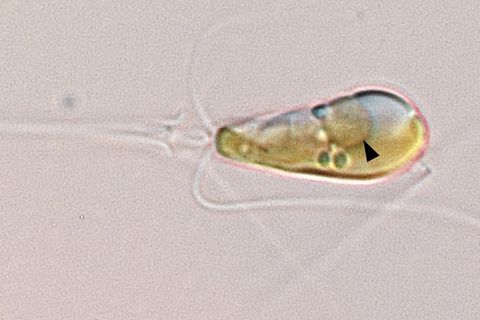 Die Alge Braarudospharea bigelowii in 1000facher Vergrößerung. Der schwarze Pfeil zeigt auf ein Zellorgan, das sich im Laufe der Evolution aus einem Bakterium entwickelt hat und Stickstoff aus der Luft gewinnen kann