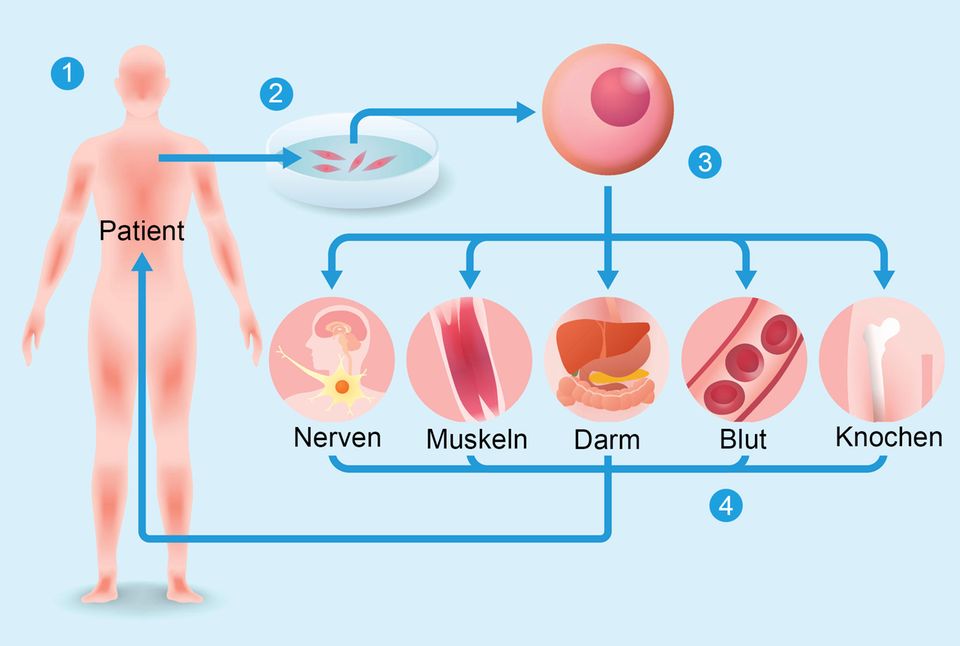 induzierte pluripotente Stammzellen (iPS-Zellen) induzierte pluripotente Stammzellen (iPS-Zellen)