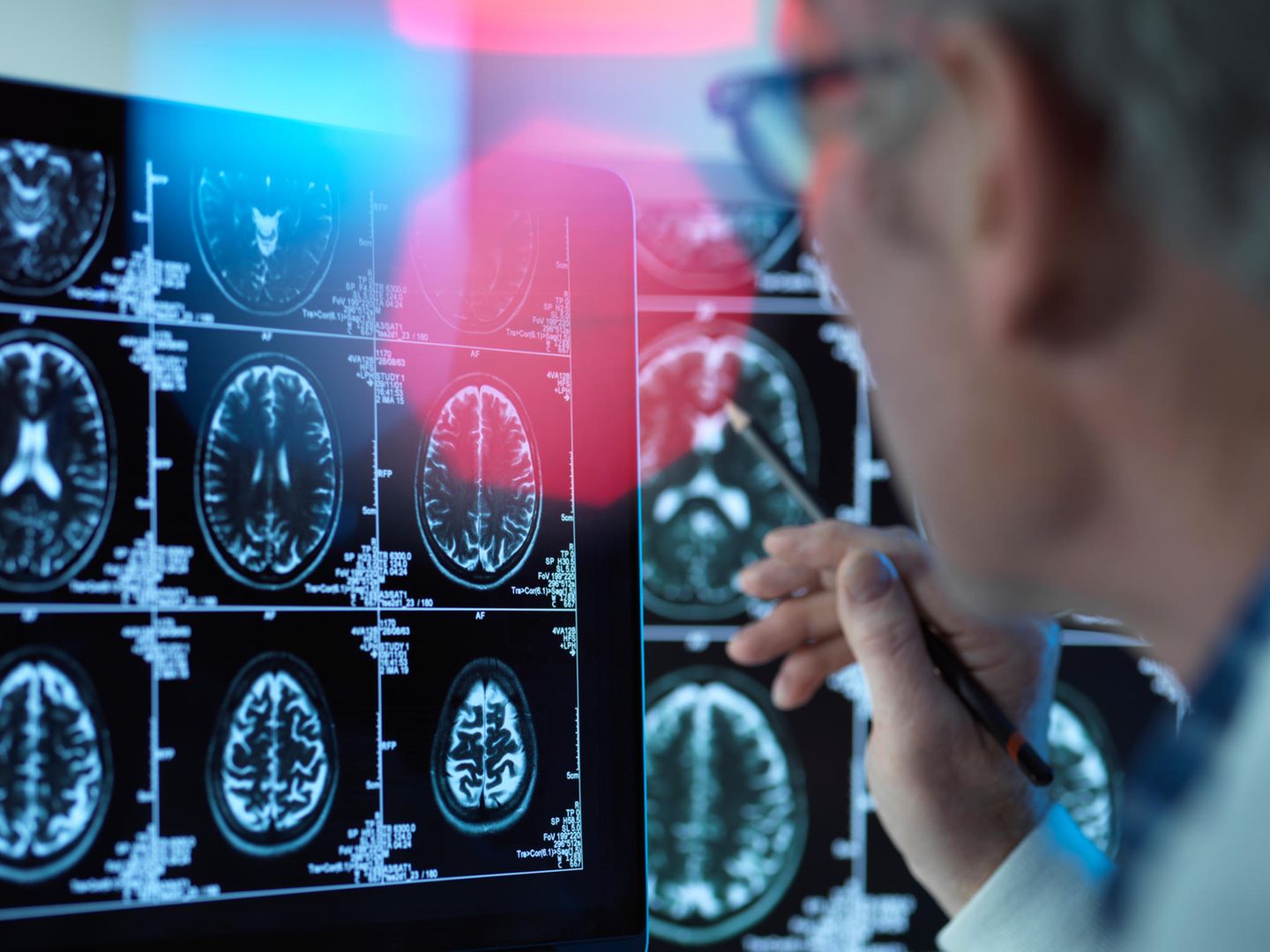 Lange vermuteten Experten psychologische Ursachen der Sprachstörung, heute gehen sie von neurologischen Gründen aus 