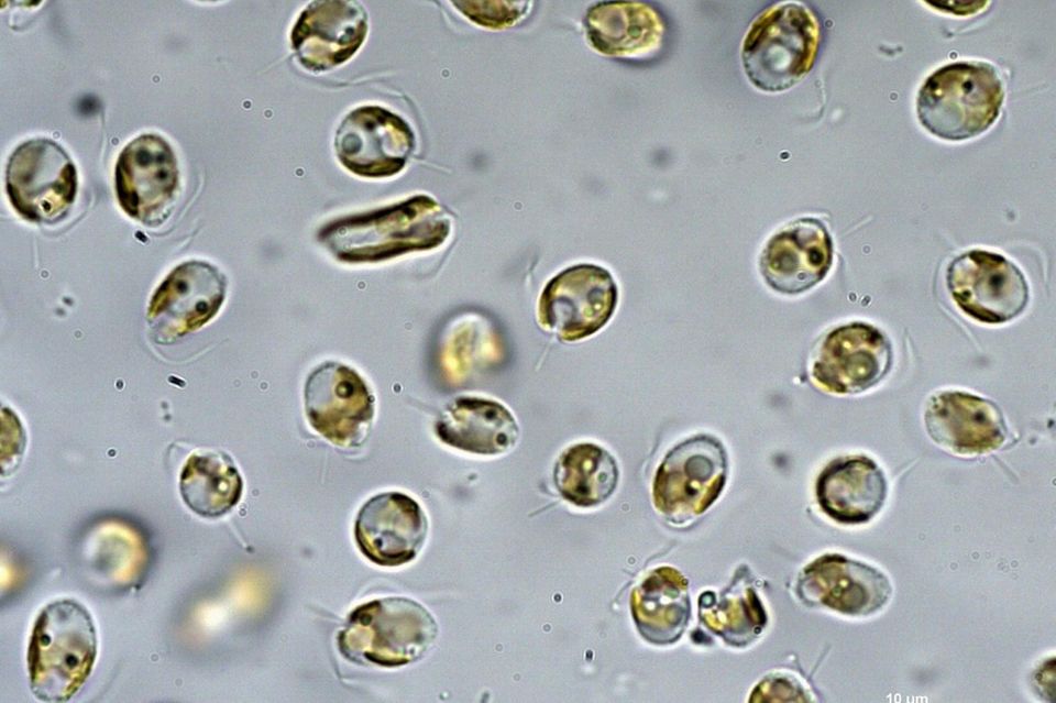 Die Goldalge Prymnesium parvum unter dem Mikroskop