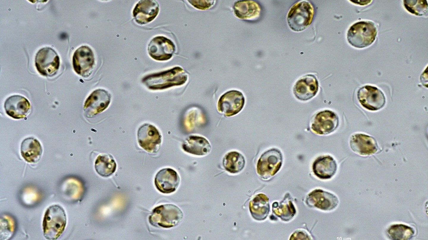 Die Goldalge Prymnesium parvum unter dem Mikroskop