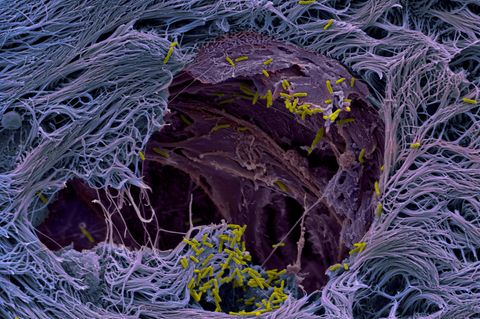 Mikroskopisch kleine Objekte lassen sich mit dem Rasterelektronenmikroskop abbilden. Es offenbart, wie der Krankenhauskeim Pseudomonas aeruginosa (grün nachkoloriert) nachgezüchtetes menschliches Lungenmikrogewebe (violett) durchdringt