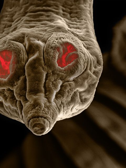 Schau mir in die Saugnäpfe, Kleines: Der Gurkenkernförmige Bandwurm (Dipylidium caninum) befällt hauptsächlich Hunde und Katzen, vereinzelt auch Menschen. Was auf dem Foto wie rot leuchtende Augenhöhlen aussieht, sind laut Fotograf David Maitland Saugnäpfe am Kopfteil des Parasiten. Dessen ungebetene Anwesenheit fällt meist kaum auf, da die Infektion häufig zu keinen oder nur geringen und unspezifischen Symptomen führt. 