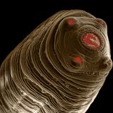 Ein Dickhalsiger Bandwurm, auch Katzenbandwurm genannt, im Larvenstadium (Cysticercus fasciolaris).