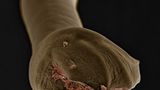 Das Schwanzende eines männlichen Hundehakenwurms (Ancylostoma caninum). Die männlichen Tiere nutzen es, um weibliche Hakenwürmer während der Paarung festzuhalten. Wie der Name vermuten lässt, sind die Parasiten besonders bei Hunden verbreitet. 