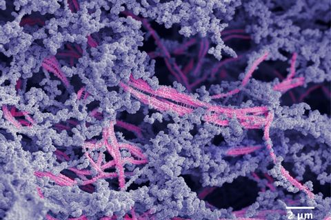 Mikrostruktur des neuen bioaktiven Materials