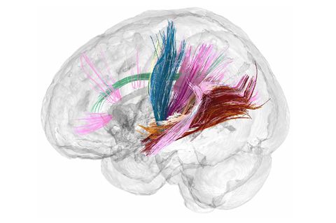 Neurowissenschaften: Graue Substanz auf Schrumpfkurs: Wie eine Schwangerschaft das Gehirn verändert