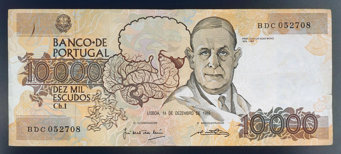 Die Herumpantscherei Viel Leid verursachte der Preisträger António Egas Moniz, und fatal war seine Ehrung mit dem Nobelpreis. Ab 1935 behandelte der portugiesische Neurologe Psychosen und Depressionen mit der von ihm entwickelten Lobotomie. Dazu drang er über zwei Löcher im Schädeldach in das Gehirn der Erkrankten ein und durchschnitt Nervenbahnen im Stirnlappen. Da die Funktionsweise des Gehirns noch weitgehend unverstanden war, hatten seine Schnitte unvorhersehbare zerstörerische Folgen. Manchen Erkrankten, die er teils gegen ihren Willen behandelte, soll es danach besser gegangen sein, andere wurden apathisch, veränderten ihre Persönlichkeit oder wurden gar zu Pflegefällen. Die Lobotomie war hochumstritten, doch die Kritik verstummte, als Moniz 1949 den Nobelpreis für Medizin zugesprochen bekam. Sein Verfahren wurde weltweit populär. Erst die Entdeckung von Psychopharmaka konnte die Methode nach und nach verdrängen, und spätestens mit dem Buch "Einer flog über das Kuckucksnest" und dessen oscarprämierter Verfilmung wendete sich auch die Öffentlichkeit gegen die Lobotomie.