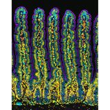 Der Schnitt durch den Dünndarm einer Maus zeigt die stark vergrößerte Oberfläche der Darmschleimhaut, über die verwertbare Nährstoffe in den Körper aufgenommen werden.