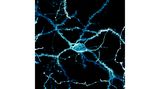 Nervenzelle aus dem sogenannten Striatum einer Ratte: Dieser Teil des Gehirns ist in hochkomplexe, motorische Regelkreise eingebunden und spielt eine wichtige Rolle bei Kognition und Motivation.