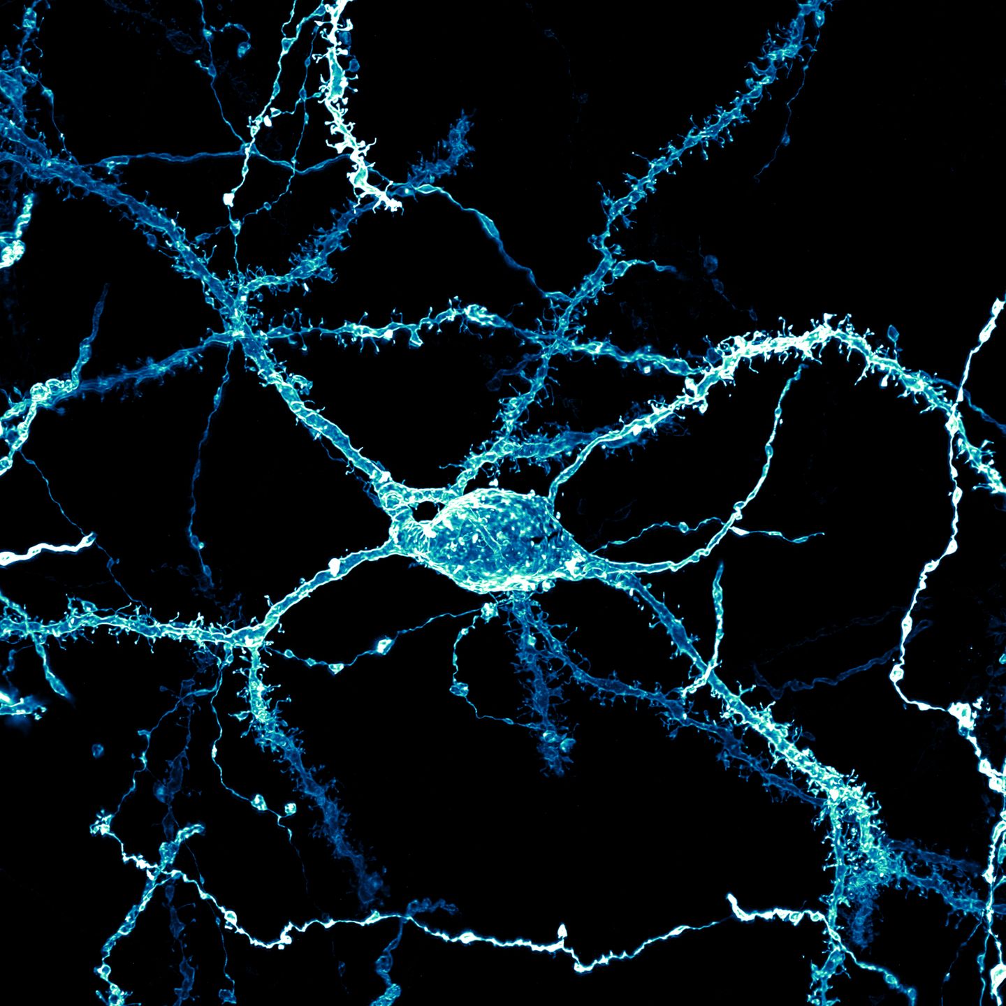 Nervenzelle aus dem sogenannten Striatum einer Ratte: Dieser Teil des Gehirns ist in hochkomplexe, motorische Regelkreise eingebunden und spielt eine wichtige Rolle bei Kognition und Motivation.