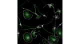 Der erste Preis geht zum 50-jährigen Jubiläum der Nikon Small World Photomicrography Competition an Dr. Bruno Cisterna und Dr. Eric Vitriol von der Augusta University in Georgia, USA. Ihre bahnbrechende Aufnahme zeigt das Zytoskelett, die Mikrotubuli und die Zellkerne von Gehirntumorzellen von Mäusen. "Ich verbrachte etwa drei Monate damit, das Färbeverfahren zu perfektionieren, um eine klare Sichtbarkeit der Zellen zu gewährleisten", erklärt Wettbewerbssieger Cisterna. Doch damit nicht genug: "Nachdem ich den Zellen fünf Tage Zeit gegeben hatte, sich zu differenzieren, musste ich das richtige Sichtfeld finden, in dem die differenzierten und nicht differenzierten Zellen interagierten." Für das Foto habe er mehrere Versuche und zahllose Stunden gebraucht.