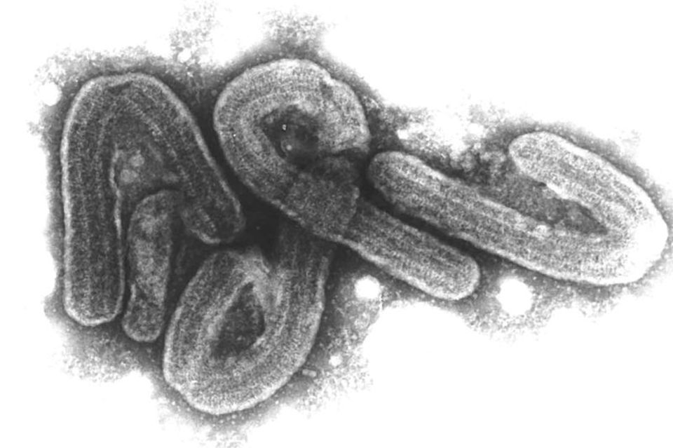 Elektronenmikroskopische Aufnahme des Marburg-Virus. Das Marburg-Virus gehört zu den gefährlichsten bekannten Krankheitserregern