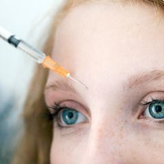 Nahaufnahme der Stirn einer jungen Frau, die eine Botoxspritze bekommt