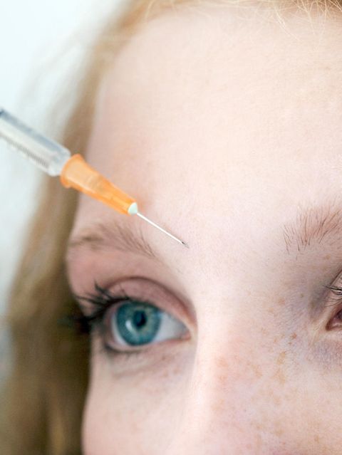 Nahaufnahme der Stirn einer jungen Frau, die eine Botoxspritze bekommt