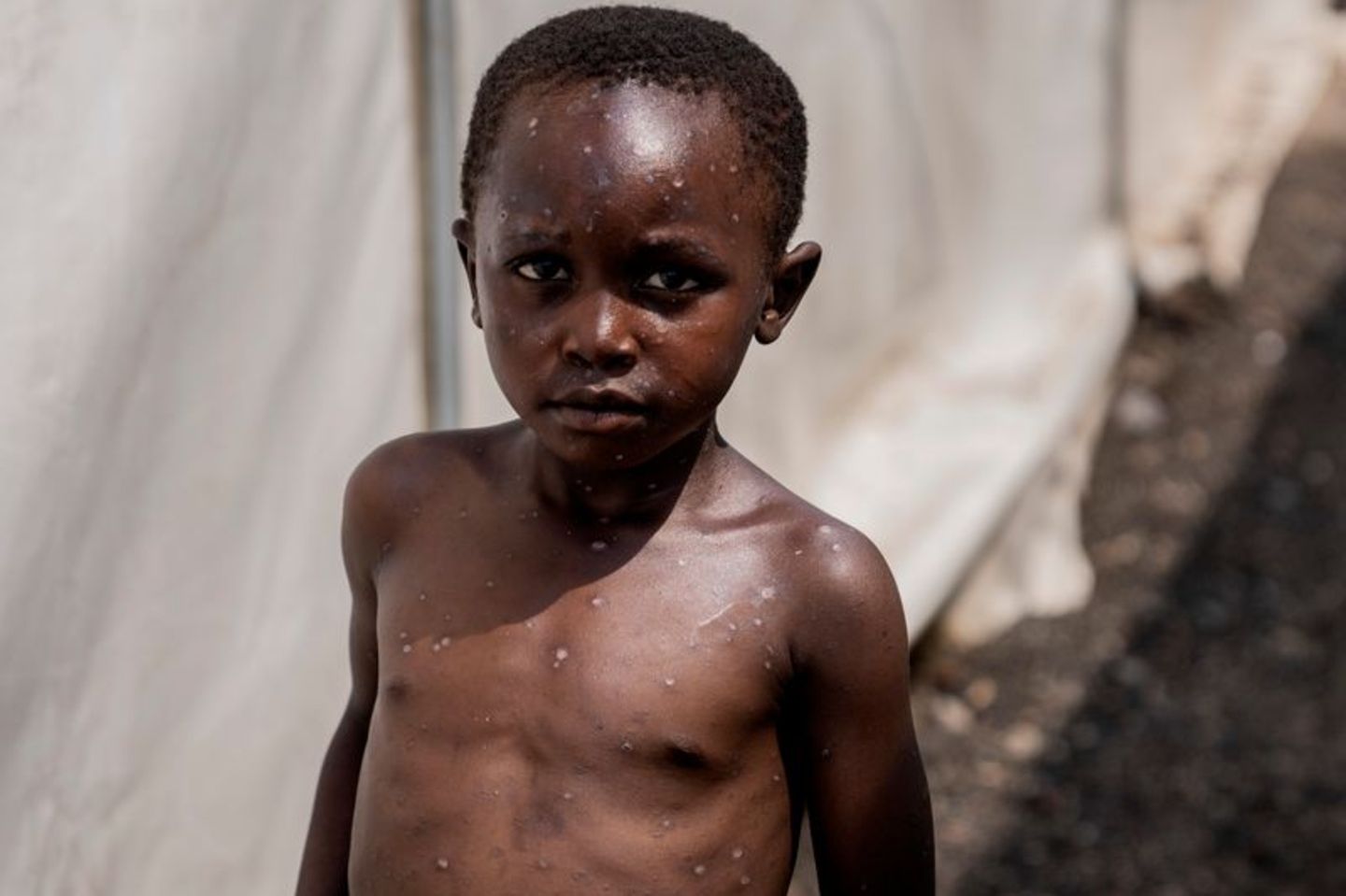 For immunized children and men, health can be very good. (Archivbild) Photo: Moses Sawasawa/AP/dpa