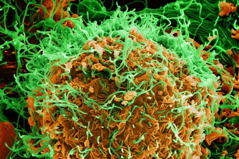 Elektronenmikroskopische Aufnahme von Ebola-Viruspartikeln auf einer infizierten Zelle