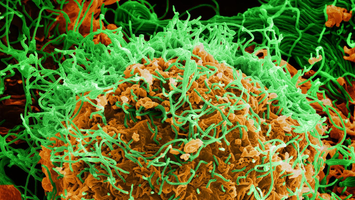 Neue-Erkenntnisse-Hochgef-hrliches-Ebolavirus-verbreitet-sich-vermutlich-auch-ber-die-Haut