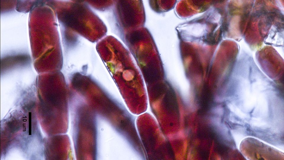 Unter dem Mikroskop ist die dunkle Färbung der Mikroalgen gut zu erkennen