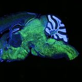 Schnitt eines fluoreszierenden Mäusehirns unter dem Mikroskop