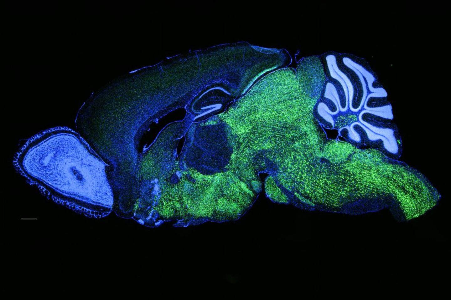 Schnitt eines fluoreszierenden Mäusehirns unter dem Mikroskop