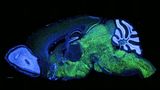 Schnitt eines fluoreszierenden Mäusehirns unter dem Mikroskop