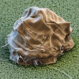 Gar nicht mehr bärenhaft sieht dieses Bärtierchen aus. Unter lebensfeindlichen Bedingungen rollt es sich wie ein Sack zusammen und geht in das sogenannte Tönnchenstadium über. Dann zeigt es keinerlei Lebenszeichen mehr – und kann sich doch auch nach langer Zeit wieder zurück in ein lebendiges Bärtierchen verwandeln. Wie das möglich ist, hat die Wissenschaft bis heute nicht ganz verstanden. 