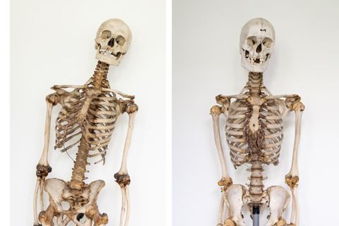 Skelett des "Schinderhannes" und des "Schwarzen Jonas"