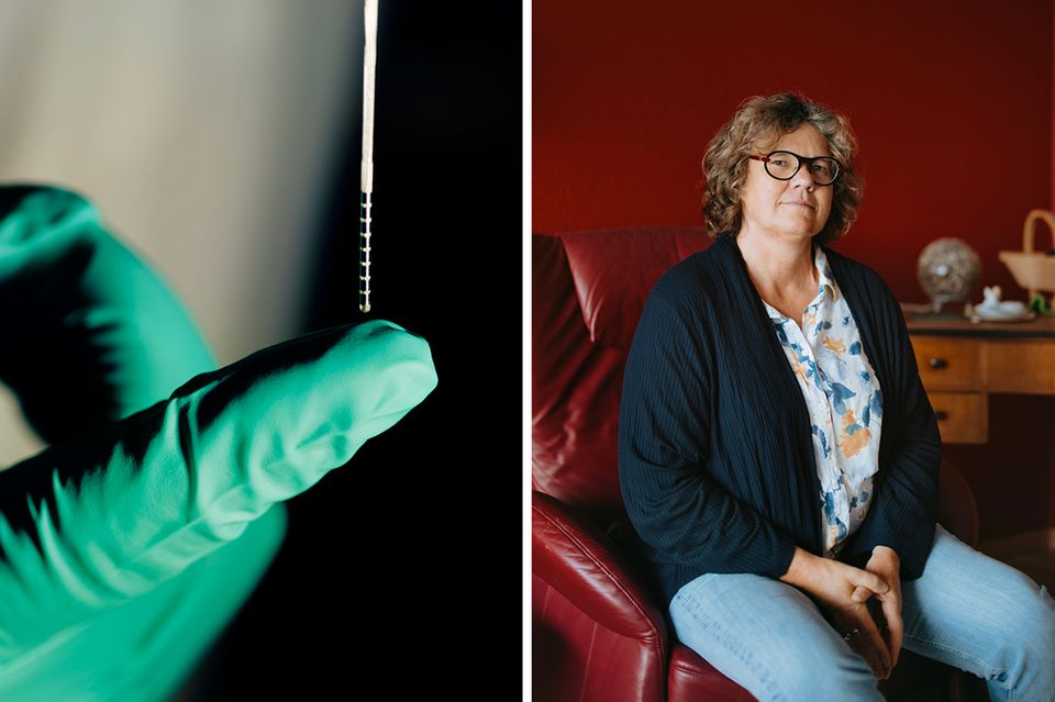 Keine Therapie konnte bislang Monika Kelles Depression lindern. Das schafft nun eine stabförmige Elektrode in ihrem Gehirn mithilfe von kleinen Stromstößen. Die Tiefe Hirnstimulation könnte die Psychiatrie revolutionieren  1.4989