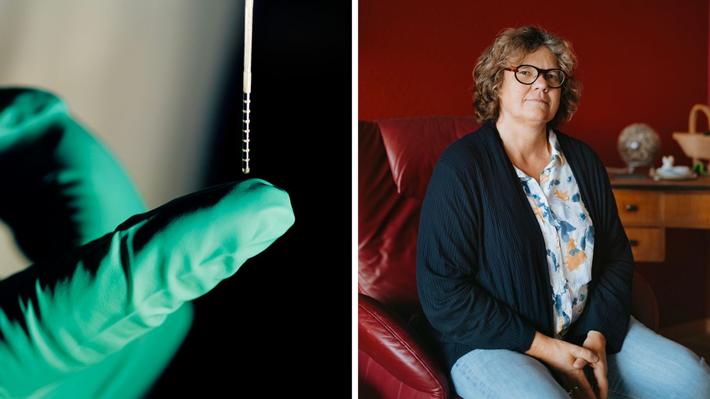 Keine Therapie konnte bislang Monika Kelles Depression lindern. Das schafft nun eine stabförmige Elektrode in ihrem Gehirn mithilfe von kleinen Stromstößen. Die Tiefe Hirnstimulation könnte die Psychiatrie revolutionieren 