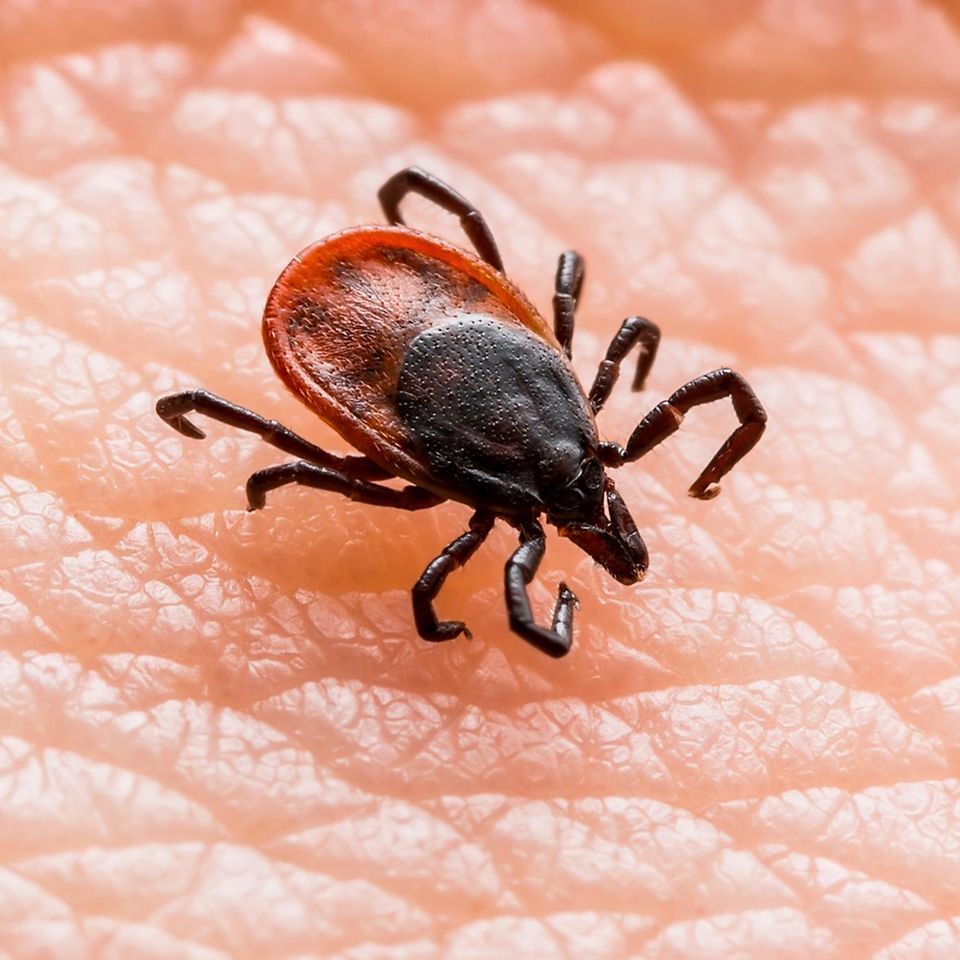 Zecken suchen am Körper nach geschützten Stellen, um zuzustechen