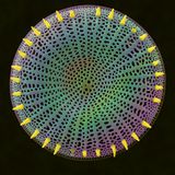 Makrofoto einer gefärbten Kieselalge