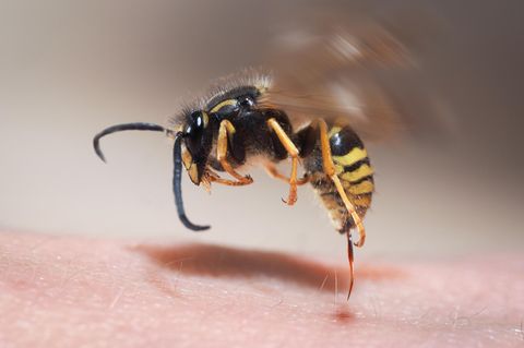 Unangehm sind Wespenstiche immer. Doch rund zwei bis drei Prozent der Bevölkerung haben eine echte Allergie auf Wespen- oder Bienengift
