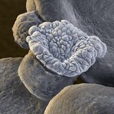 Organoide sind kleine Strukturen aus Zellen und Geweben, die im Labor zu einem „Mini-Organ“ gezüchtet werden