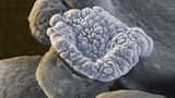 Organoide sind kleine Strukturen aus Zellen und Geweben, die im Labor zu einem „Mini-Organ“ gezüchtet werden