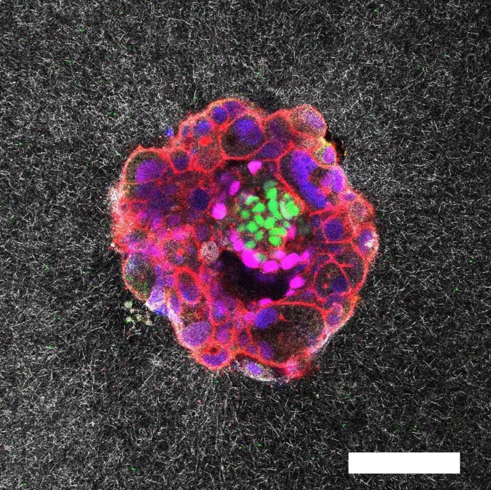Forschende filmen erstmals, wie sich ein Embryo einnistet - [GEO]