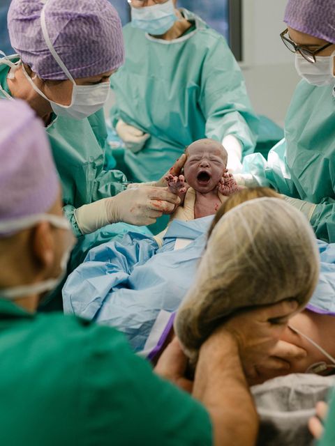 Der Moment der Geburt: Beim mütterlich assistierten Kaiserschnitt greift die Mutter ihrem Baby unter die Arme und hebt es aus dem Bauch auf ihre Brust. Die Bilder zeigen nicht Ann-Kathrin und Marc, sondern ein anderes Paar, das in der Heidelberger Klinik St. Elisabeth sein Kind zur Welt brachte