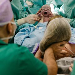 Der Moment der Geburt: Beim mütterlich assistierten Kaiserschnitt greift die Mutter ihrem Baby unter die Arme und hebt es aus dem Bauch auf ihre Brust. Die Bilder zeigen nicht Ann-Kathrin und Marc, sondern ein anderes Paar, das in der Heidelberger Klinik St. Elisabeth sein Kind zur Welt brachte