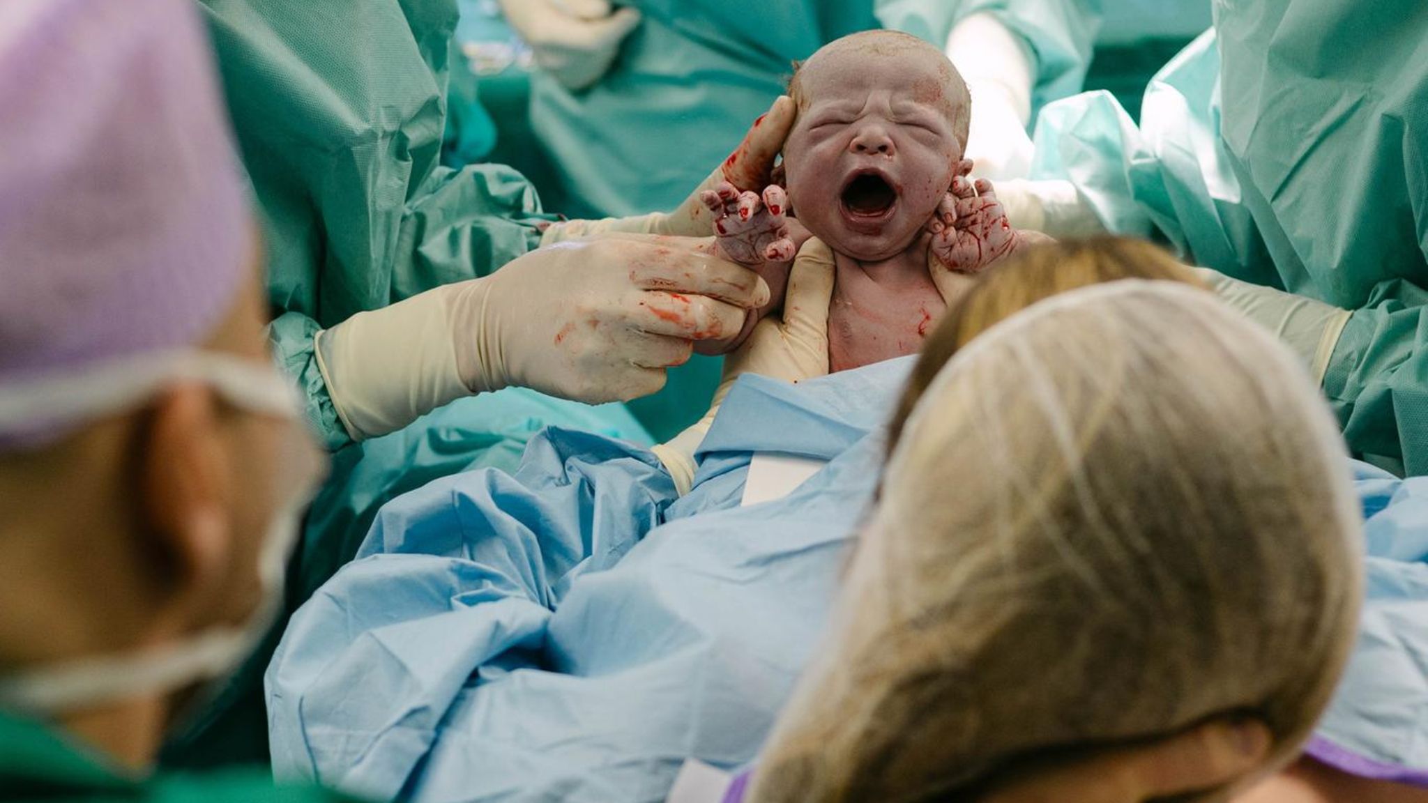 Der Moment der Geburt: Beim mütterlich assistierten Kaiserschnitt greift die Mutter ihrem Baby unter die Arme und hebt es aus dem Bauch auf ihre Brust. Die Bilder zeigen nicht Ann-Kathrin und Marc, sondern ein anderes Paar, das in der Heidelberger Klinik St. Elisabeth sein Kind zur Welt brachte