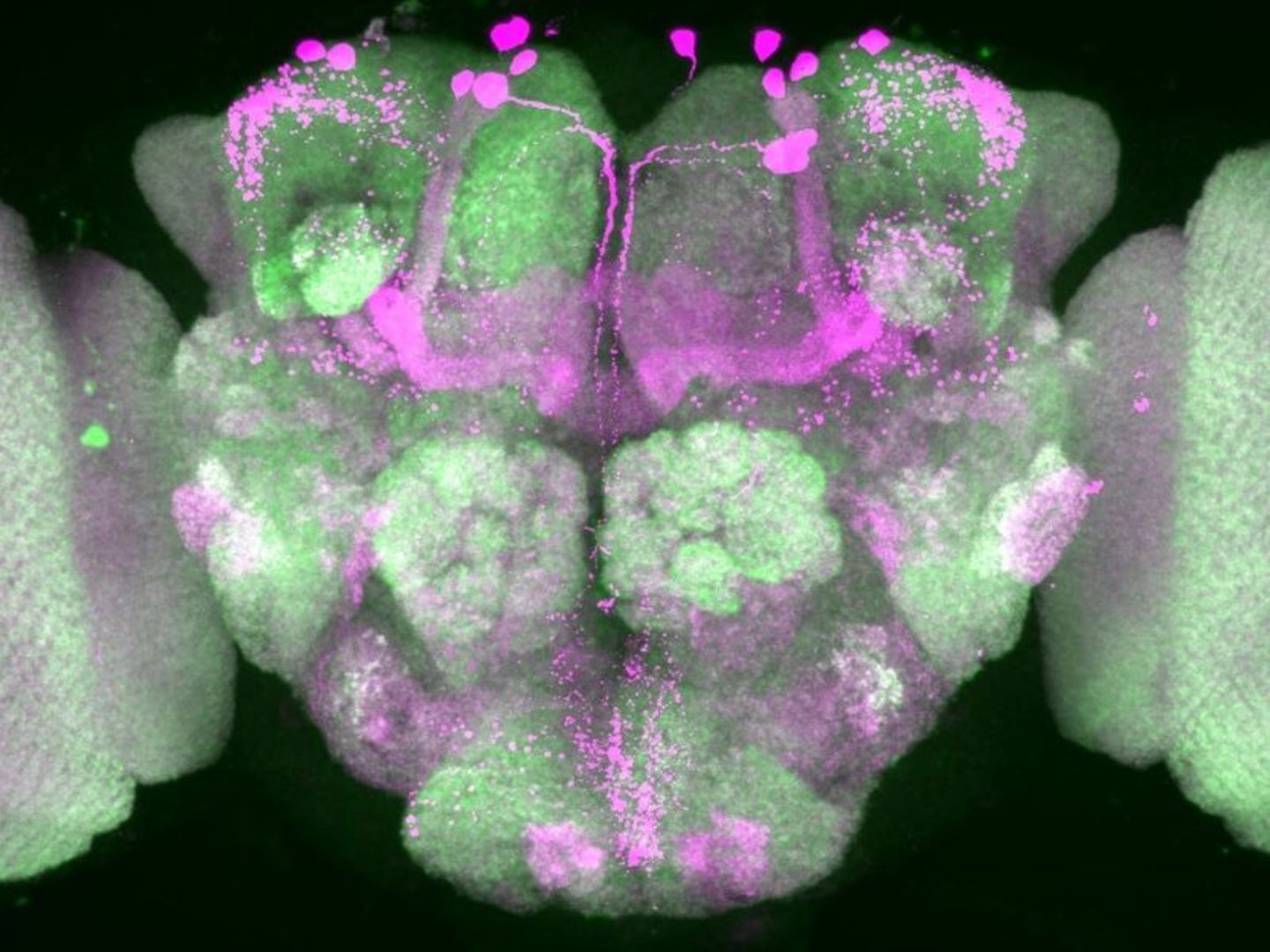 Nervenzellen im Gehirn einer Taufliege wurden durch Forscher pink eingefärbt, Nervenzellenverbindungen sind grün dargestellt