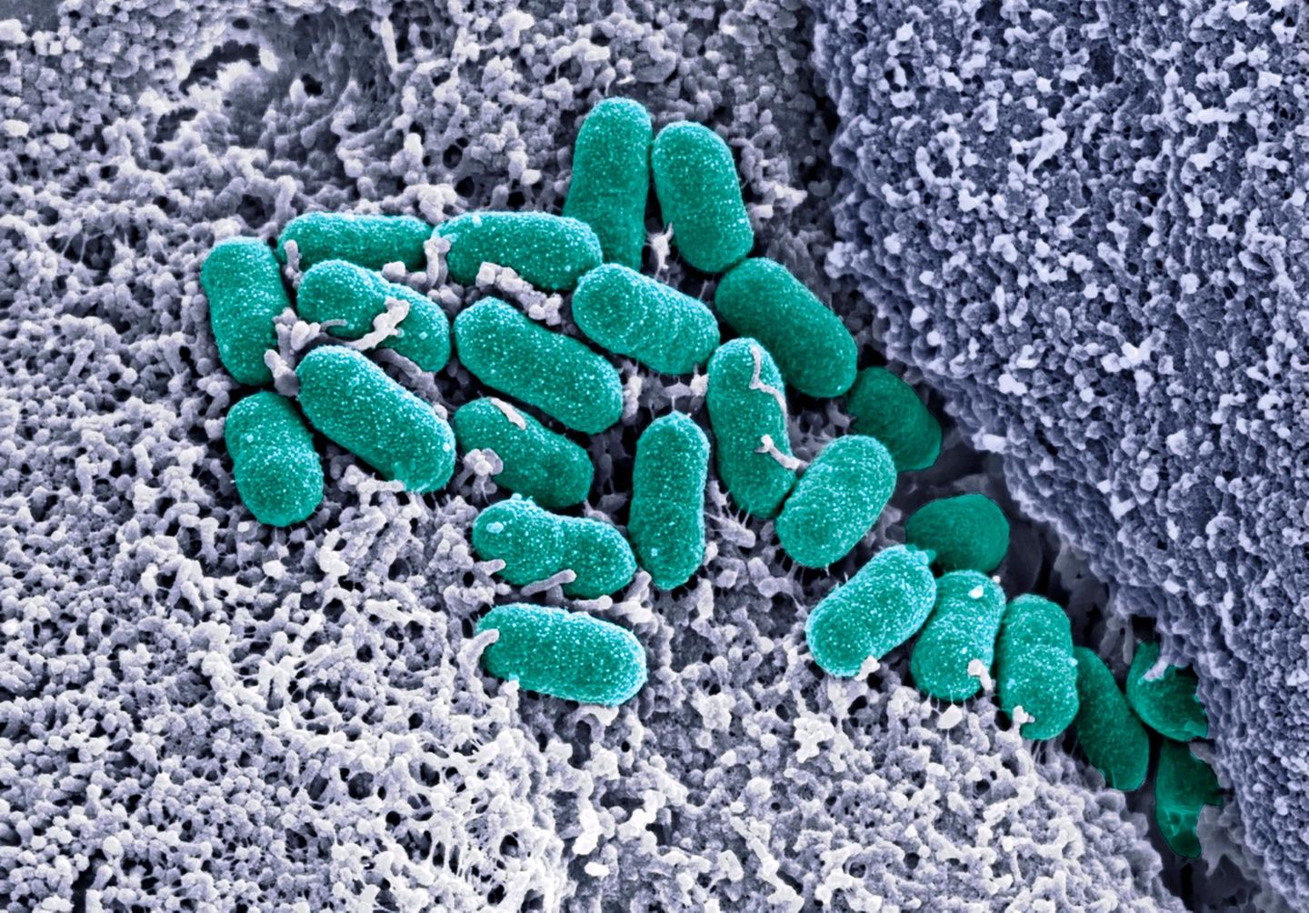 Ehec-Bakterium