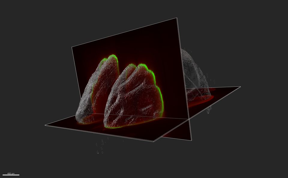 Neurobiologie: Die 3D-Ansicht eines Mausgehirns mit genetischen Veränderungen, die in der Großhirnrinde Falten erzeugen. Der grüne Marker hebt die obersten kortikalen Schichten hervor Die 3D-Ansicht eines Mausgehirns mit genetischen Veränderungen, die in der Großhirnrinde Falten erzeugen. Der grüne Marker hebt die obersten kortikalen Schichten hervor