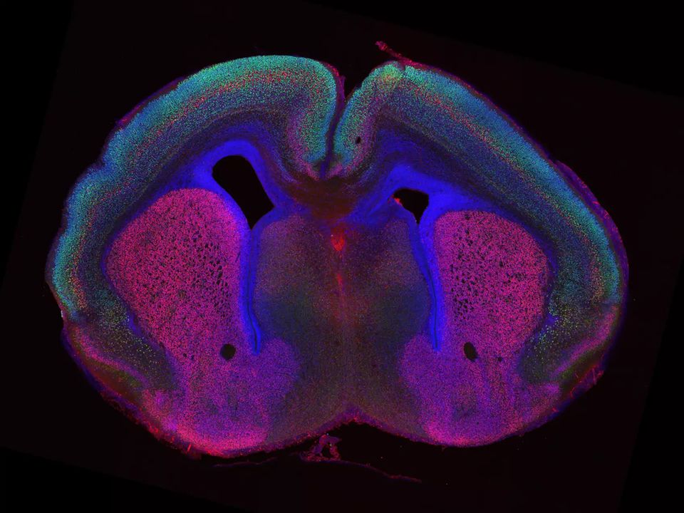 Neurobiologie: Ins Mäusegehirn wurden Markern gespritzt, um verschiedene Arten von Nervenzellen hervorzuheben. Man sieht kaum Falten, nur zwei Furchen auf der linken Seite Ins Mäusegehirn wurden Markern gespritzt, um verschiedene Arten von Nervenzellen hervorzuheben. Man sieht kaum Falten, nur zwei Furchen auf der linken Seite