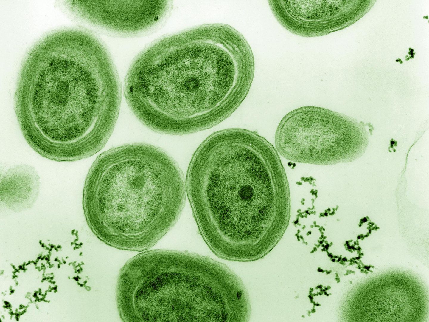 Prochlorococcus
