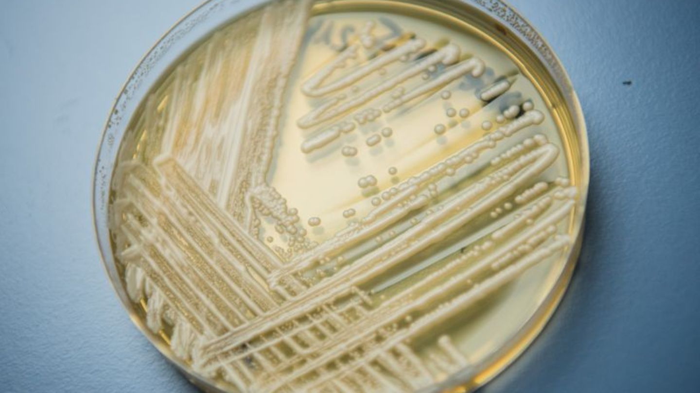Der Hefepilz Candidozyma auris (früher bekannt als Candida auris). Foto: Nicolas Armer/dpa
