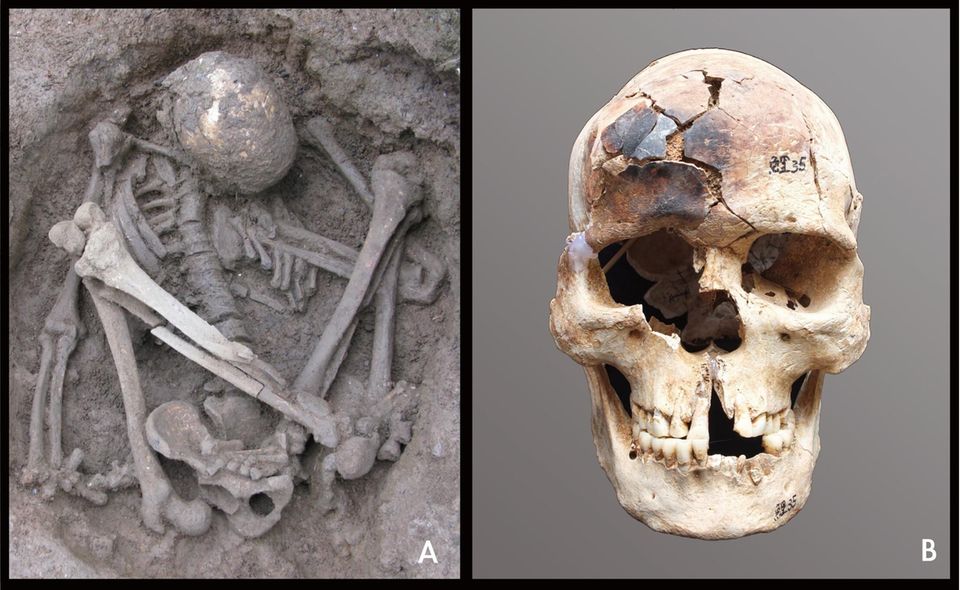 Dieser Fund wird auf etwa 7.000 Jahre datiert. Es handelt sich um einen jungen Mann mit teilweise verbranntem Schädel